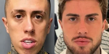 MC Daniel mostra antes e depois de procedimentos estéticos e novo rosto impressiona